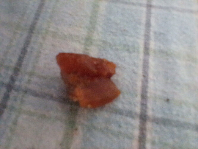 17238368028247985115978172885336